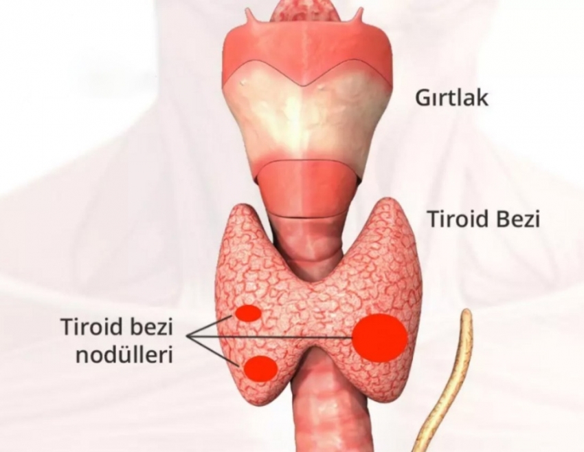 Hızlı kilo değişimi tiroidden olabilir