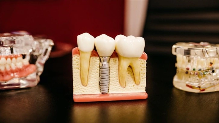 Dental turizmin 2023 beklentisi 300 milyon dolar