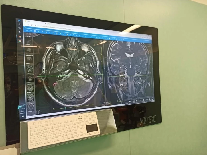 Eskişehir Şehir Hastanesinde ilk yüz felci ameliyatı gerçekleştirildi

