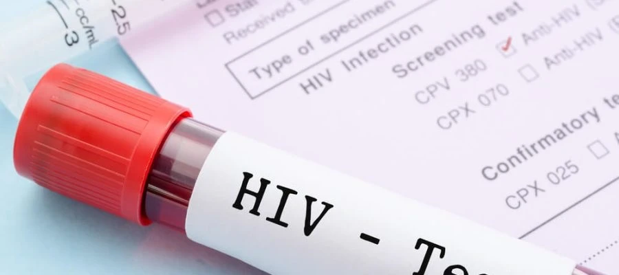 İzmir'de 13 yaşındaki çocuk AIDS'ten öldü 