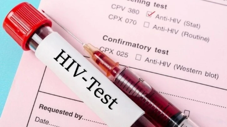 HIV dünyada düşerken Türkiye'de 4 kat arttı