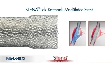 Aort anevrizmasına STENA stent tedavisi
