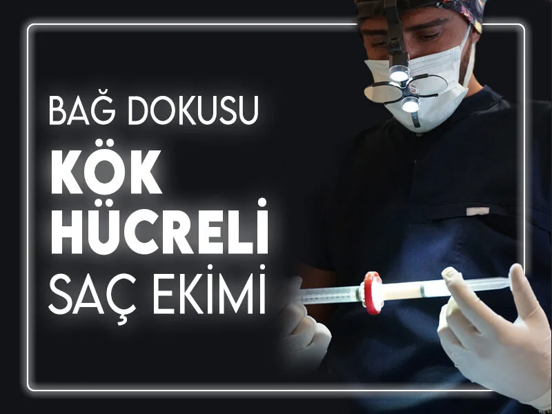 Murat Makascı Klinik’te Kök Hücreli Saç Ekimi